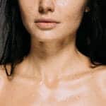 winter skincare chicago aesthetics