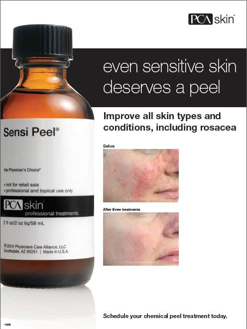 sensitive skin peel chicago aesthetics