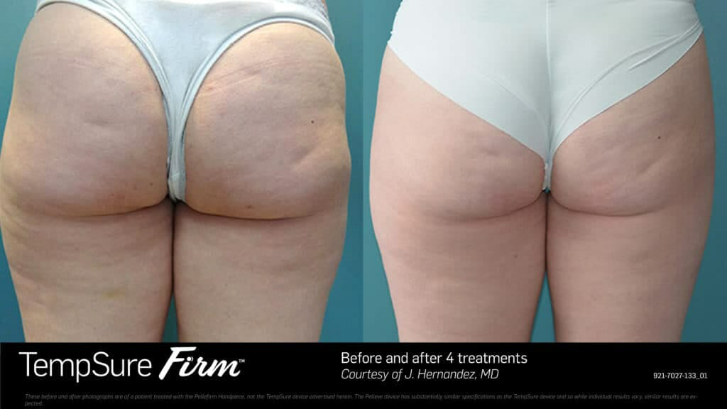 9407581E-DAA2-45E5-93FF-CC85DEE26C6D copia