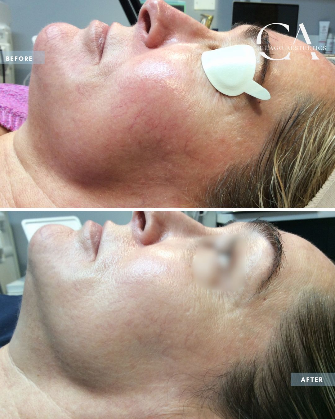 1683301 IPL Alison Falada Chicago