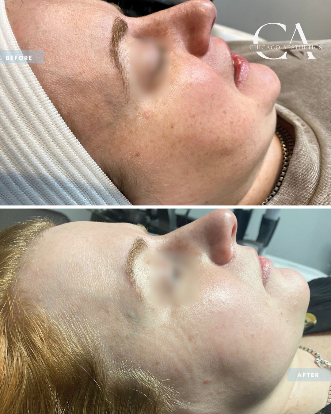 2314160 IPL Alison Falada Chicago