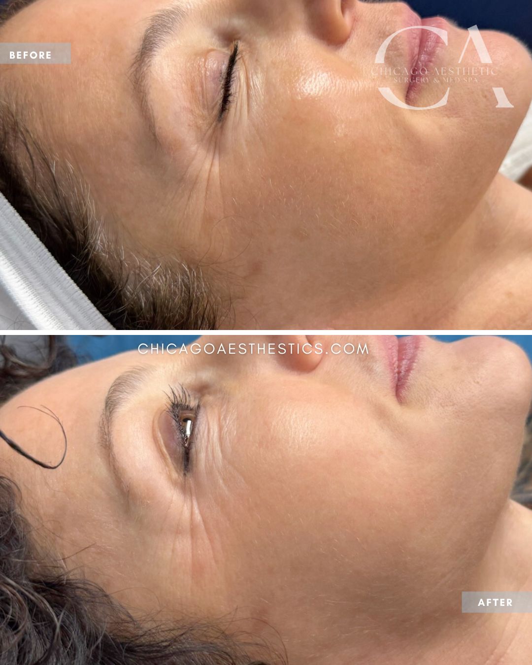 BBL_MOXI Combo Tom Recko Chicago 1tx (2)