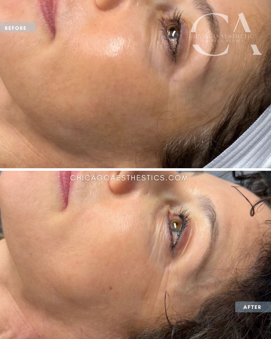 BBL_MOXI Combo Tom Recko Chicago 1tx (2)